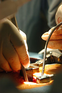 Close up of minimally invasive surgery